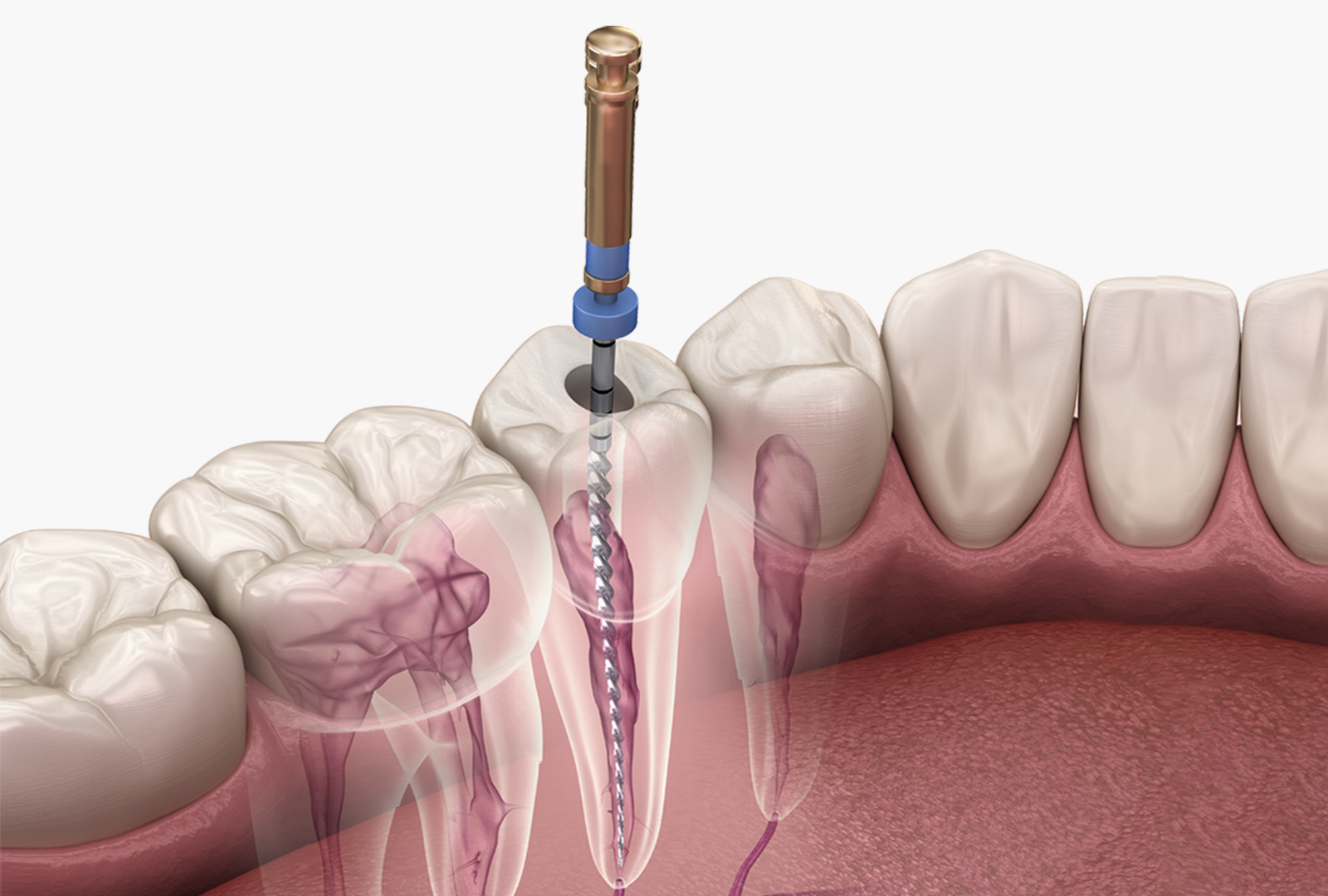 Endodontics Foundational Courses Dentsply Sirona USA
