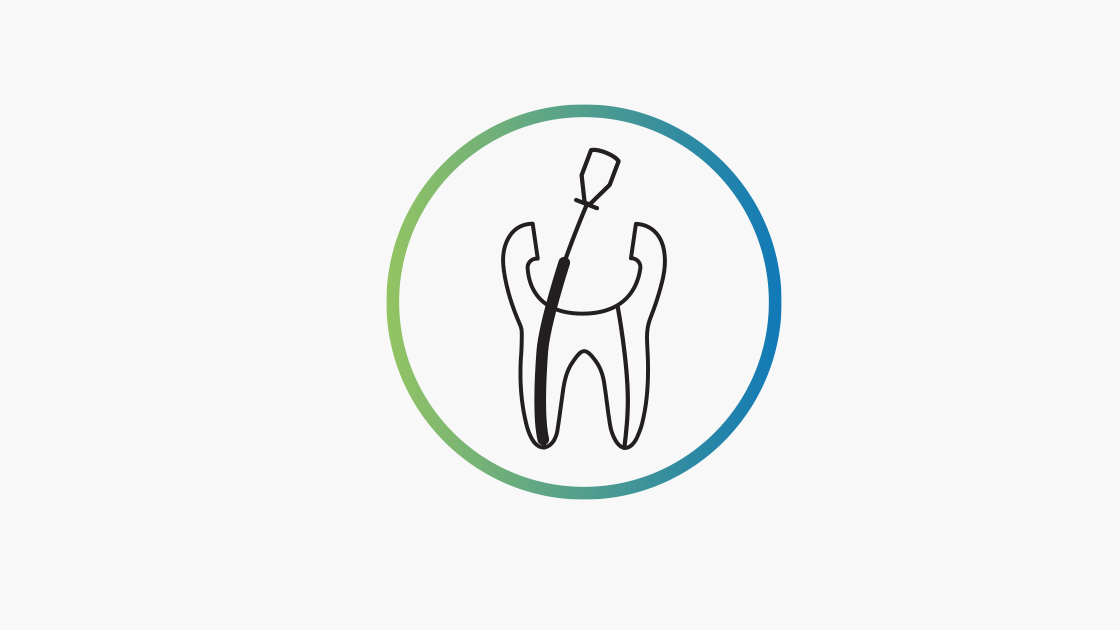 Endodontic root canal obturation Denstply Sirona USA